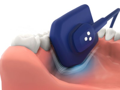Радиовизиограф EzSensor Soft